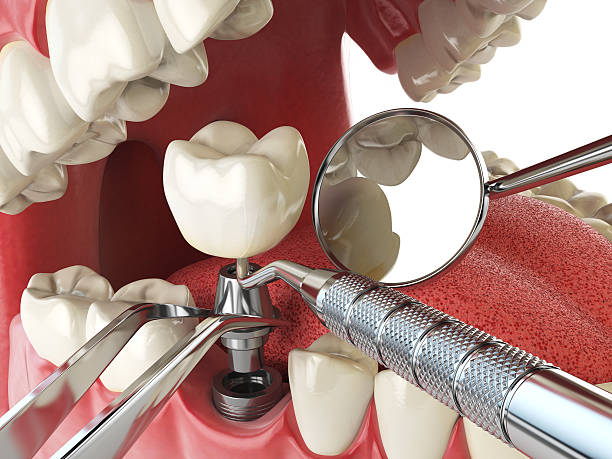 Best Broken or Cracked Tooth Emergency Dentist in Bangor, ME
